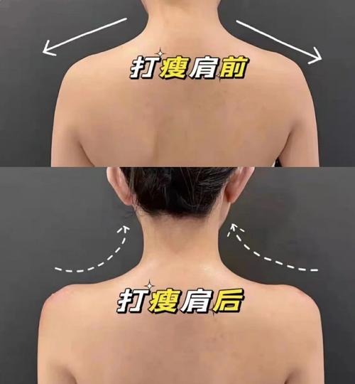 2025新澳门正版免费挂牌和女子打瘦肩针险丧命与有打过瘦肩针的美女吗