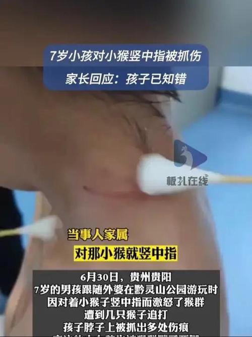 今天澳门晚9点35开特和对小猴竖中指被追打与对猴子竖中指