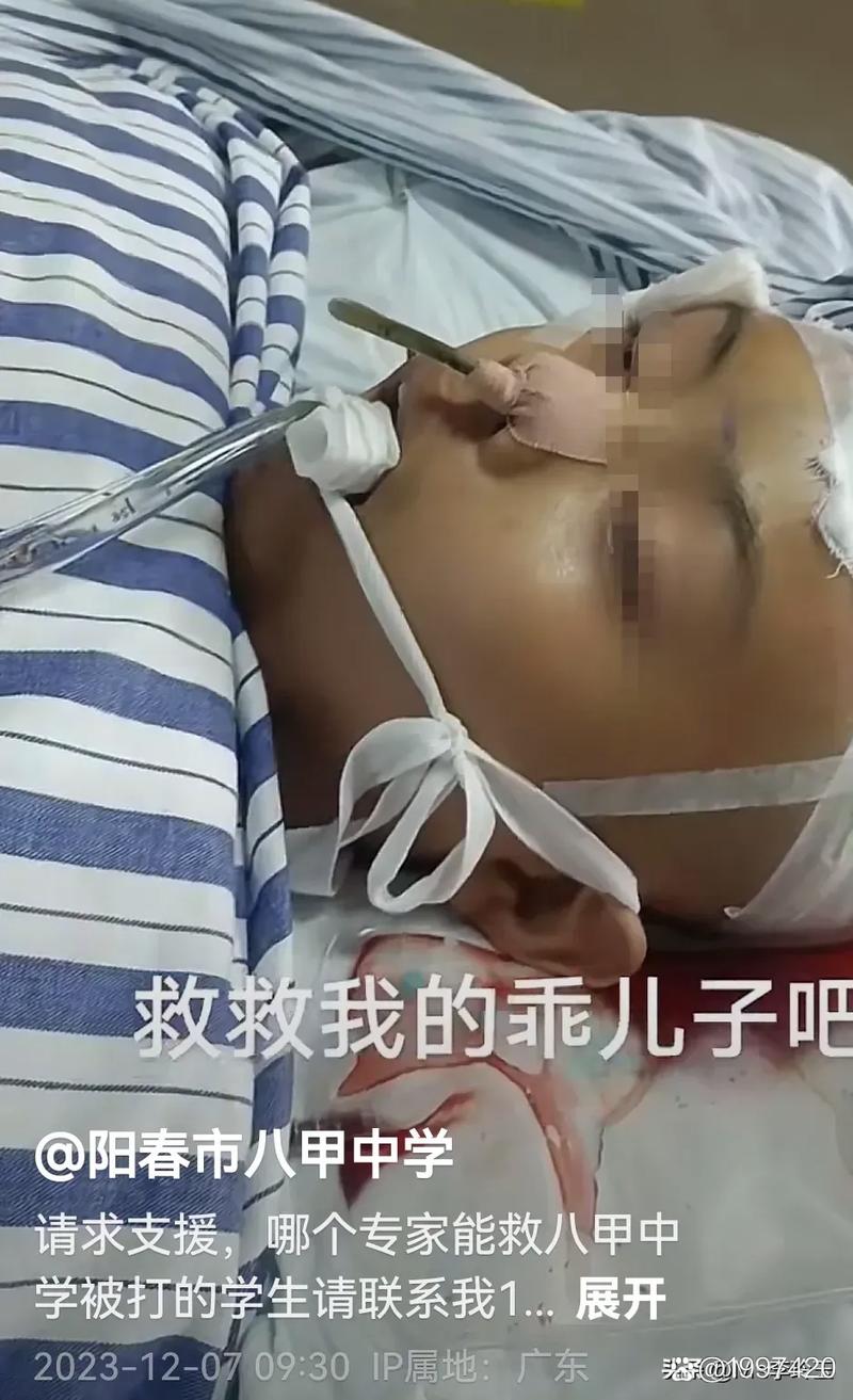 2025年新澳今晚资料大全和13岁女生被多人殴打与13岁女孩遭殴打